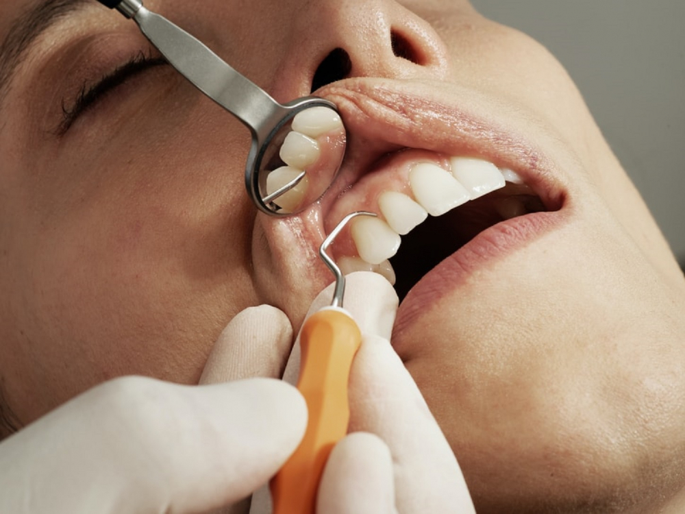 Diş çürüklerindeki hayati tehlike! Diş çürükleri kalp sağlığını etkiler mi? 11