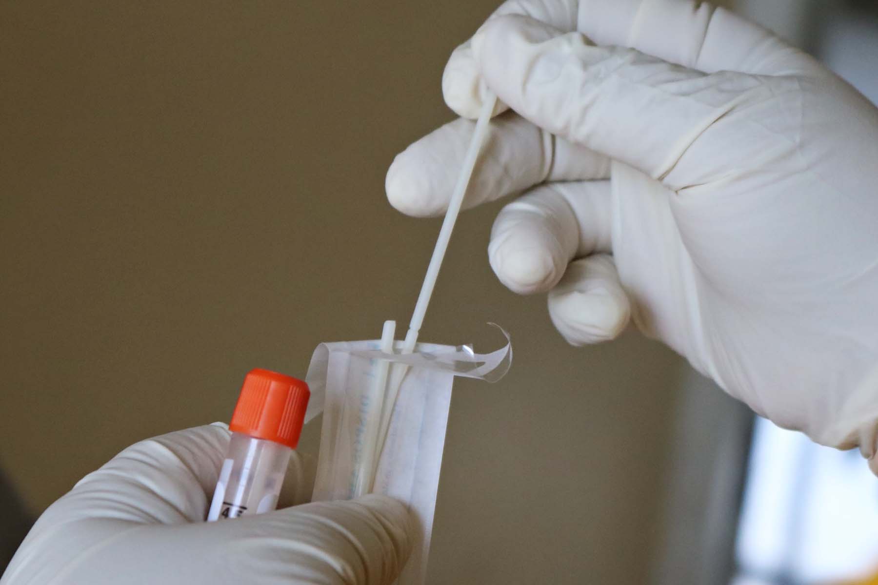 PCR testi yapan hastaneler İstanbul, Ankara, İzmir | PCR testi sonucu kaç saatte çıkar? PCR testi nerede yapılır? 
