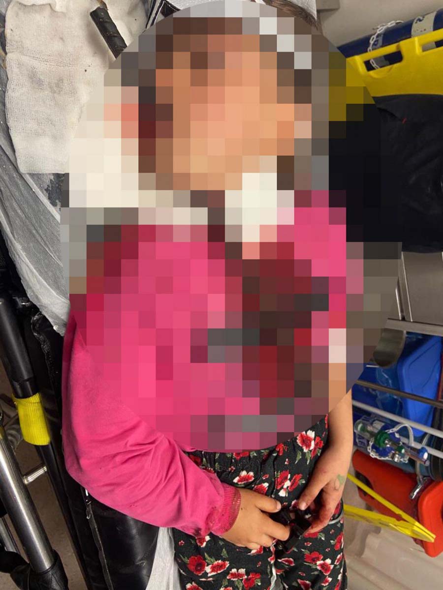 Adana Ceyhan'da akıl almaz olay! Küçük kızın boğazına demir çubuk saplandı!